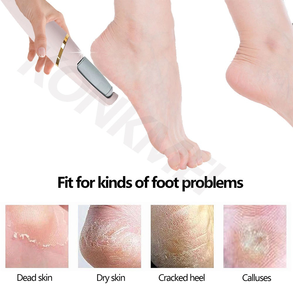 Fitlybuy electric foot grinder in white and gold being used to exfoliate dry, calloused skin on a person's foot.