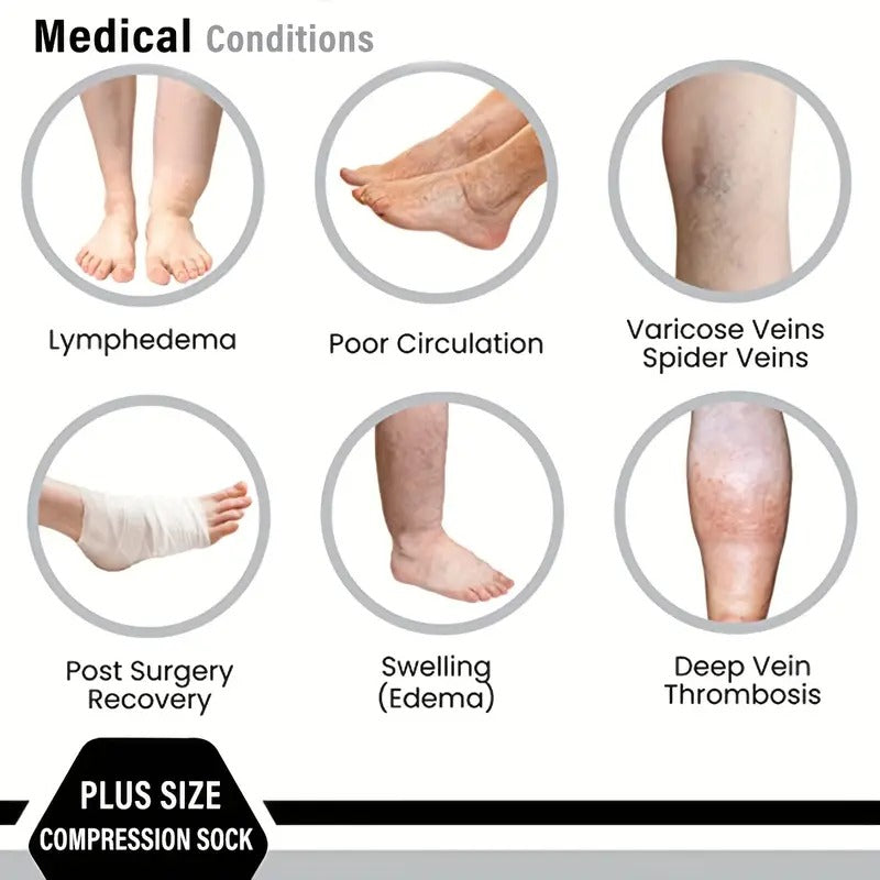 Fitlybuy VitalFlow compression socks info graphic showing leg conditions like edema, varicose veins, and surgery recovery.