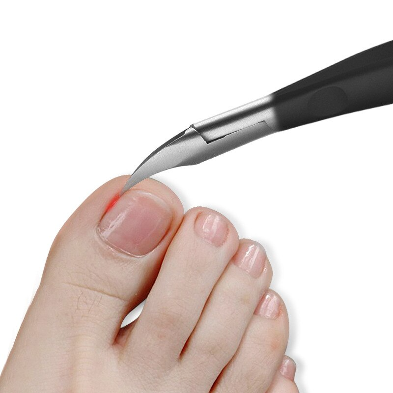 Fitlybuy NailCutter Pro with sharp steel tip treating an ingrown toenail on a human foot against a white background.
