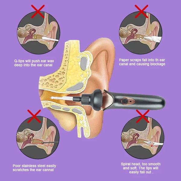 Fitlybuy ear wax removal tool shown safely cleaning an ear diagram, compared against unsafe traditional methods.