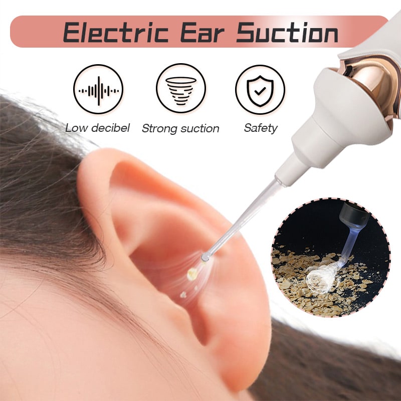 Fitlybuy electric ear wax removal tool with white and rose gold design, showing safe suction in a human ear.