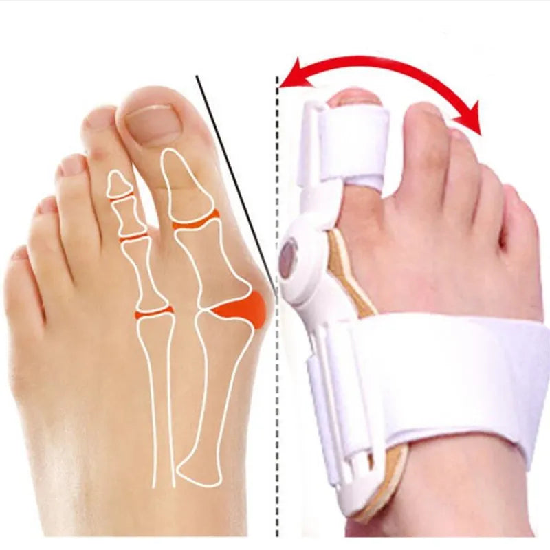 Fitlybuy white orthopaedic big toe corrector splint with adjustable strap, shown aligning a foot with a bunion.