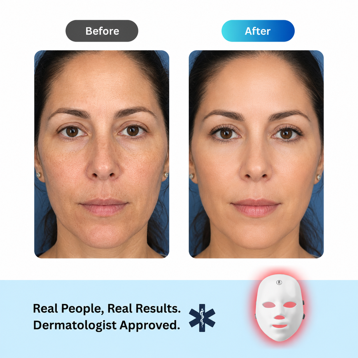 Before and after comparison of a woman using Fitlybuy Glowing Skin Red Light LED Mask for smoother, brighter skin.