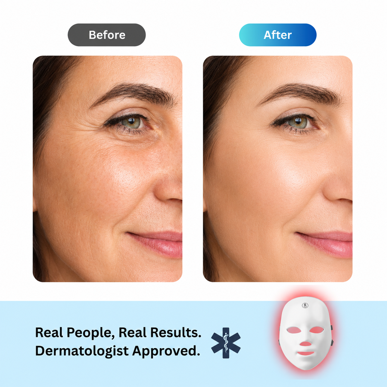 Before and after comparison of skin using Fitlybuy Glowing Skin Red Light LED Mask to reduce facial wrinkles.