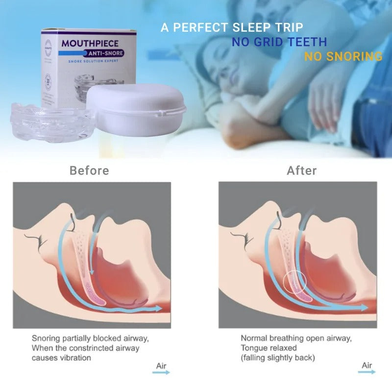 Fitlybuy clear anti-snoring mouth guard with white case, box, and diagram showing improved airway flow for better sleep.