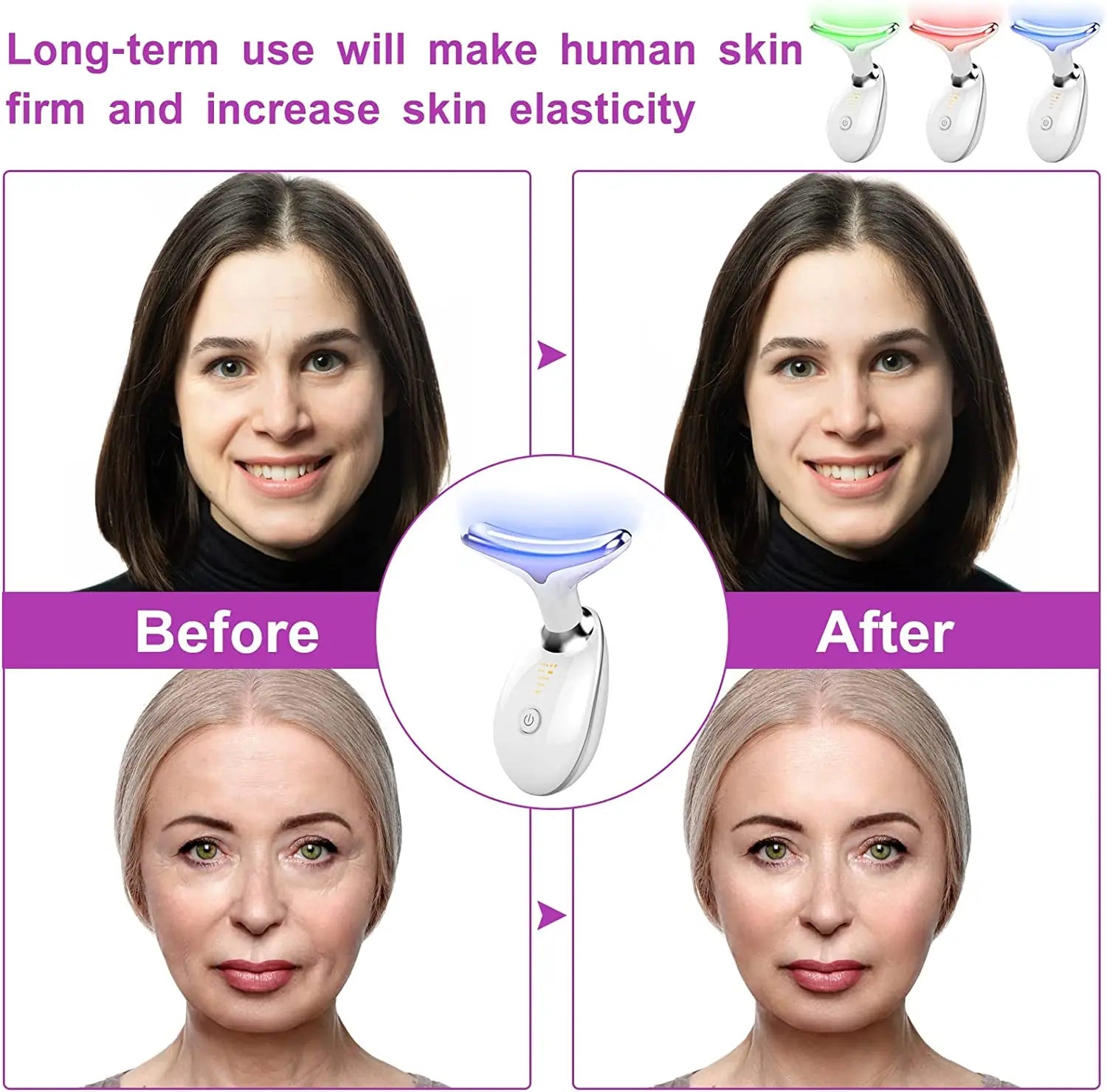 Fitlybuy white EMS neck and face massager with light therapy shown in before and after skin tightening results.