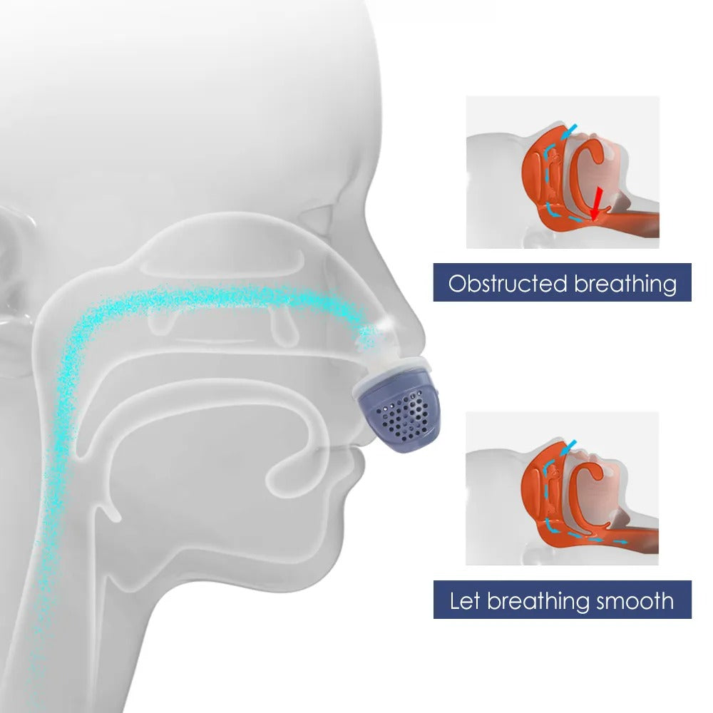 Fitlybuy blue silicone nasal dilator shown on a head model with diagrams explaining improved airflow and snoring relief.