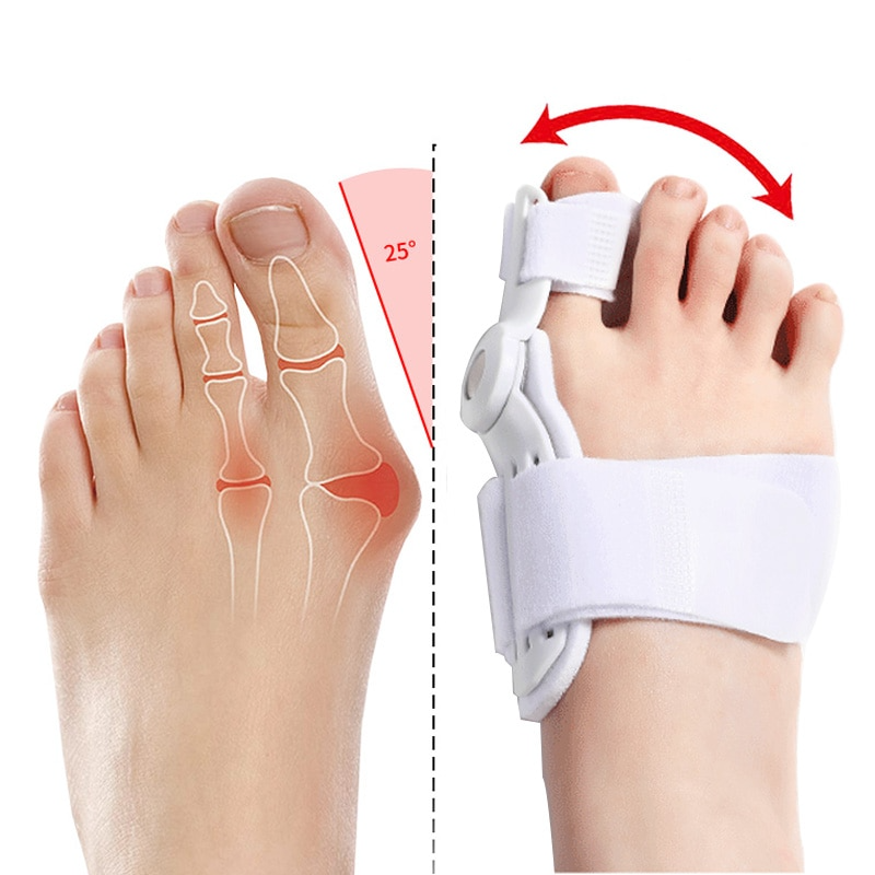 Fitlybuy adjustable white bunion corrector splint showing foot alignment correction on a human foot.