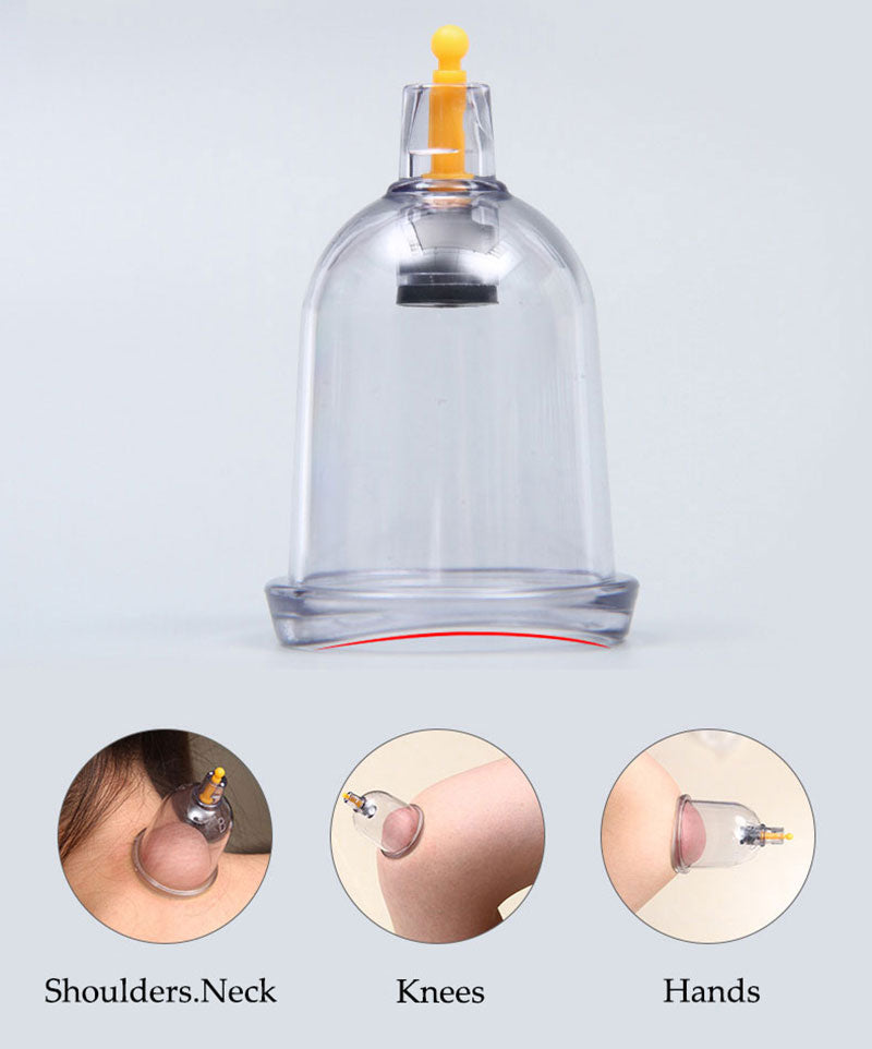 Fitlybuy clear suction cupping therapy cup with yellow valve, shown applied to shoulders, knees, and hands.