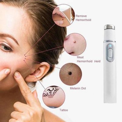 Fitlybuy white skin laser pen showing removal of skin tags, moles, and tattoos on skin.
