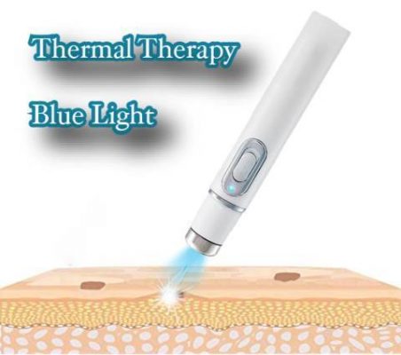 Fitlybuy Clear Skin Laser Pen, white handheld device using blue light thermal therapy on skin for acne treatment.