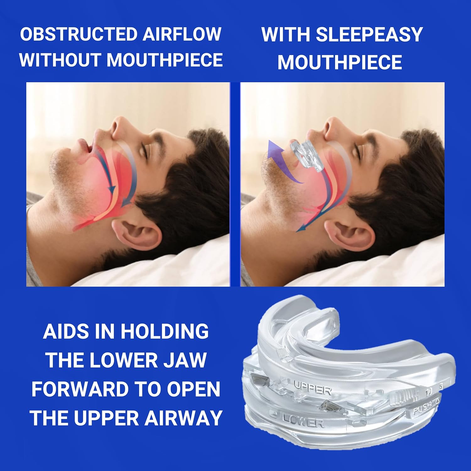 Fitlybuy clear, adjustable anti-snoring mouthpiece shown in use to open airways and improve sleep breathing.
